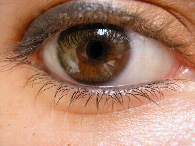 my eye