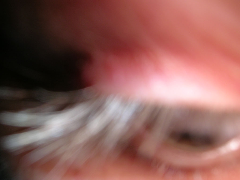 occhio2