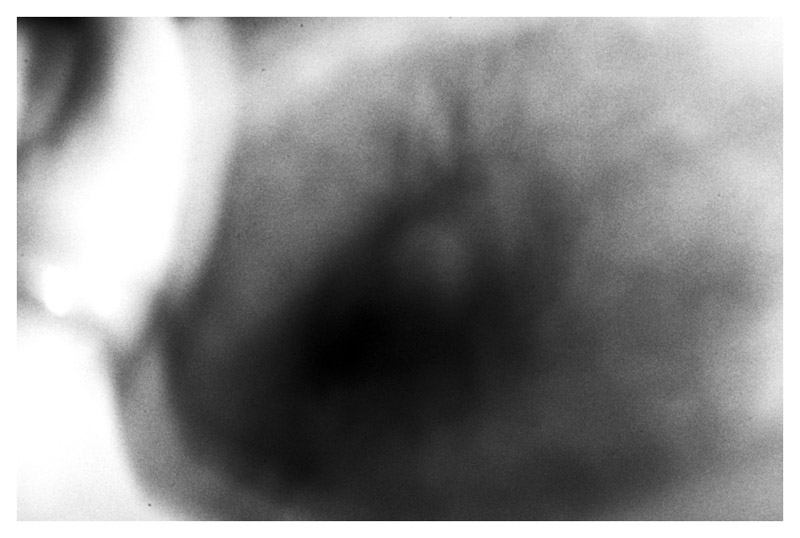 Antitesi - IV