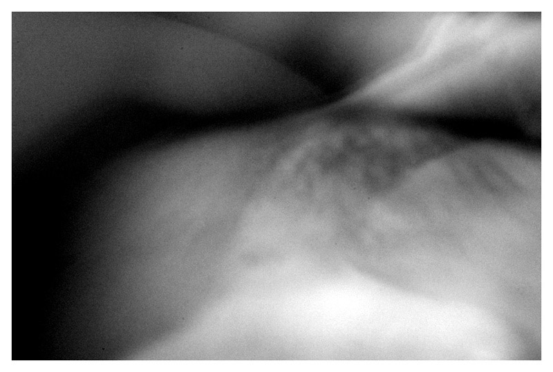 Antitesi - X
