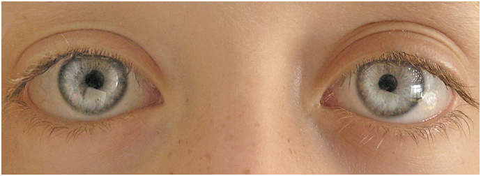 EYES