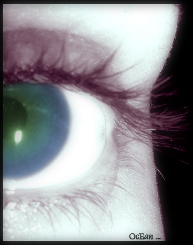 my eye