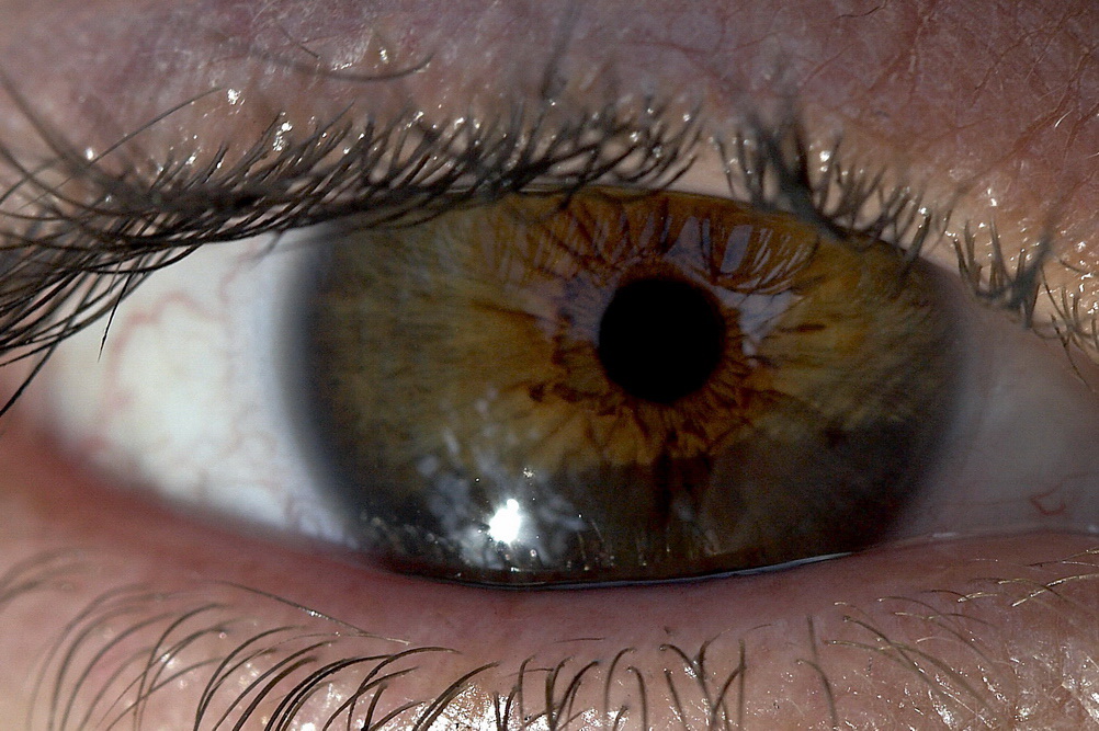 Ojo