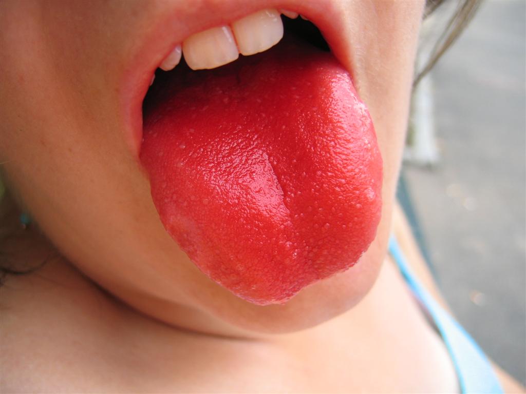Lingua dopo un ghiacciolo alla fragola.