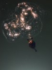 apnea