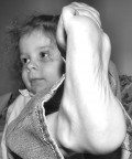 Contorsione