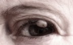 Imperfect Eye