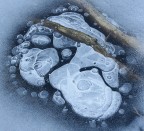 Il respiro del lago malato Il respiro del lago malato