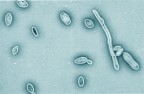 brettanomyces, il terrore di tutti quanti
io gli voglio quasi bene