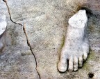 Fratture