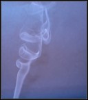 Riccioli di fumo