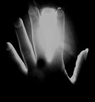Hand