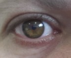 eye