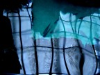 The Blue Therapy