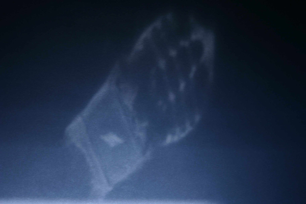 xray2.jpg